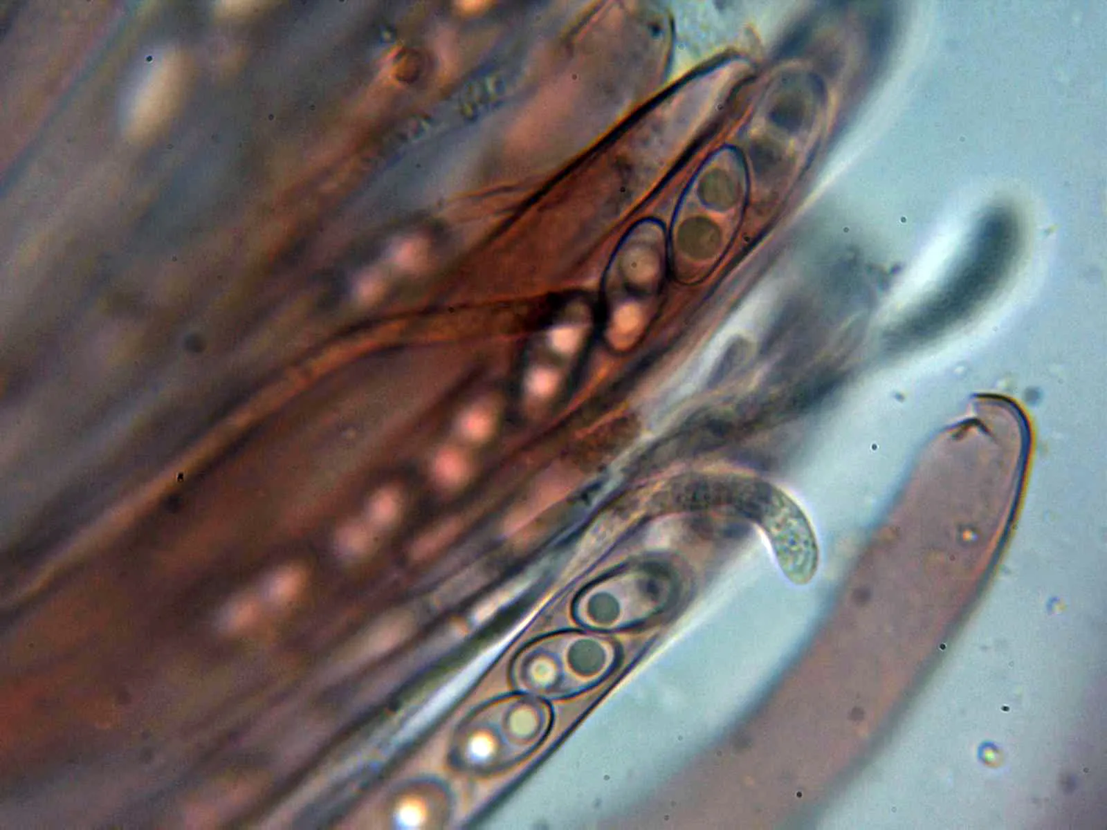 Microscopía de Otidea cochleata - 10 - Ascas y paráfisis